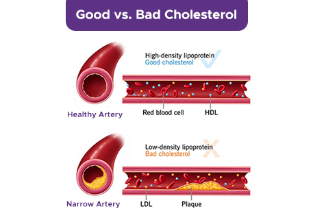 Good vs Bad Cholesterol